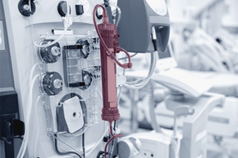 Optical quality inspection of a dialysis filter using industrial machine vision