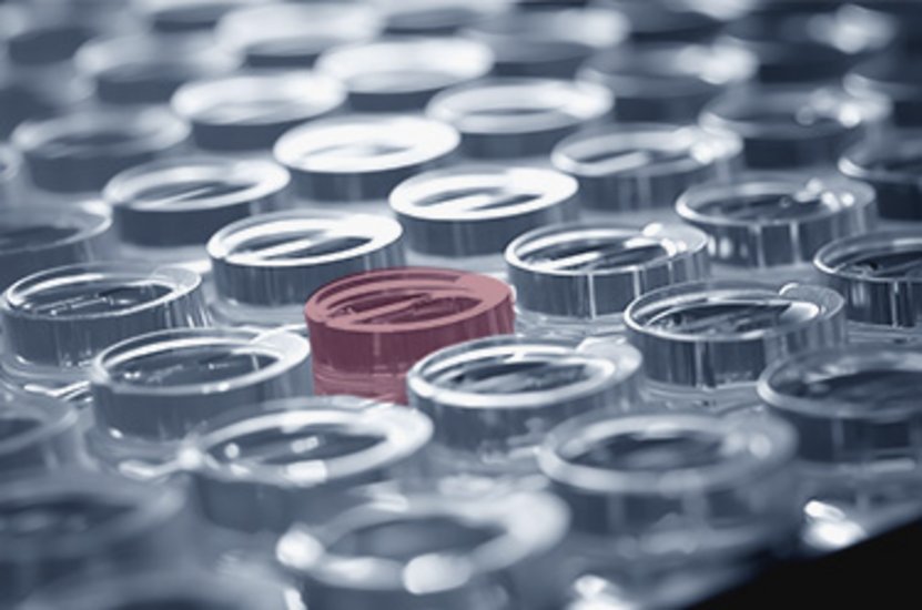 Automated quality inspection of wells and trays for laboratory applications