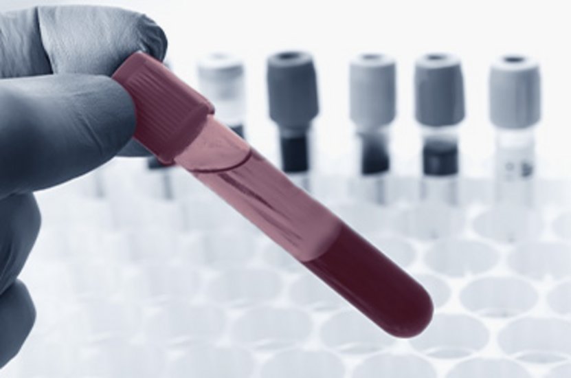 Automated optical inspection of a blood collection tube